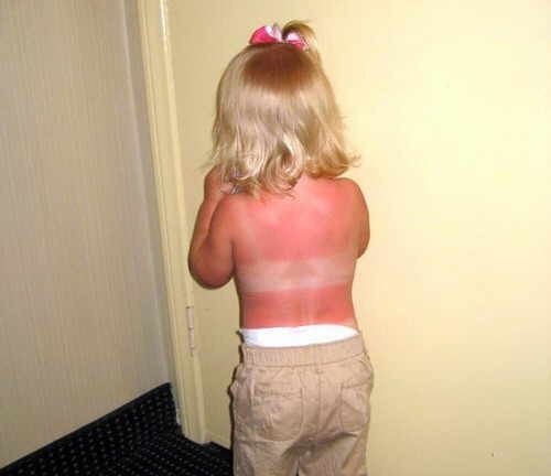 SOLNIÑO