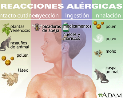 alergia3